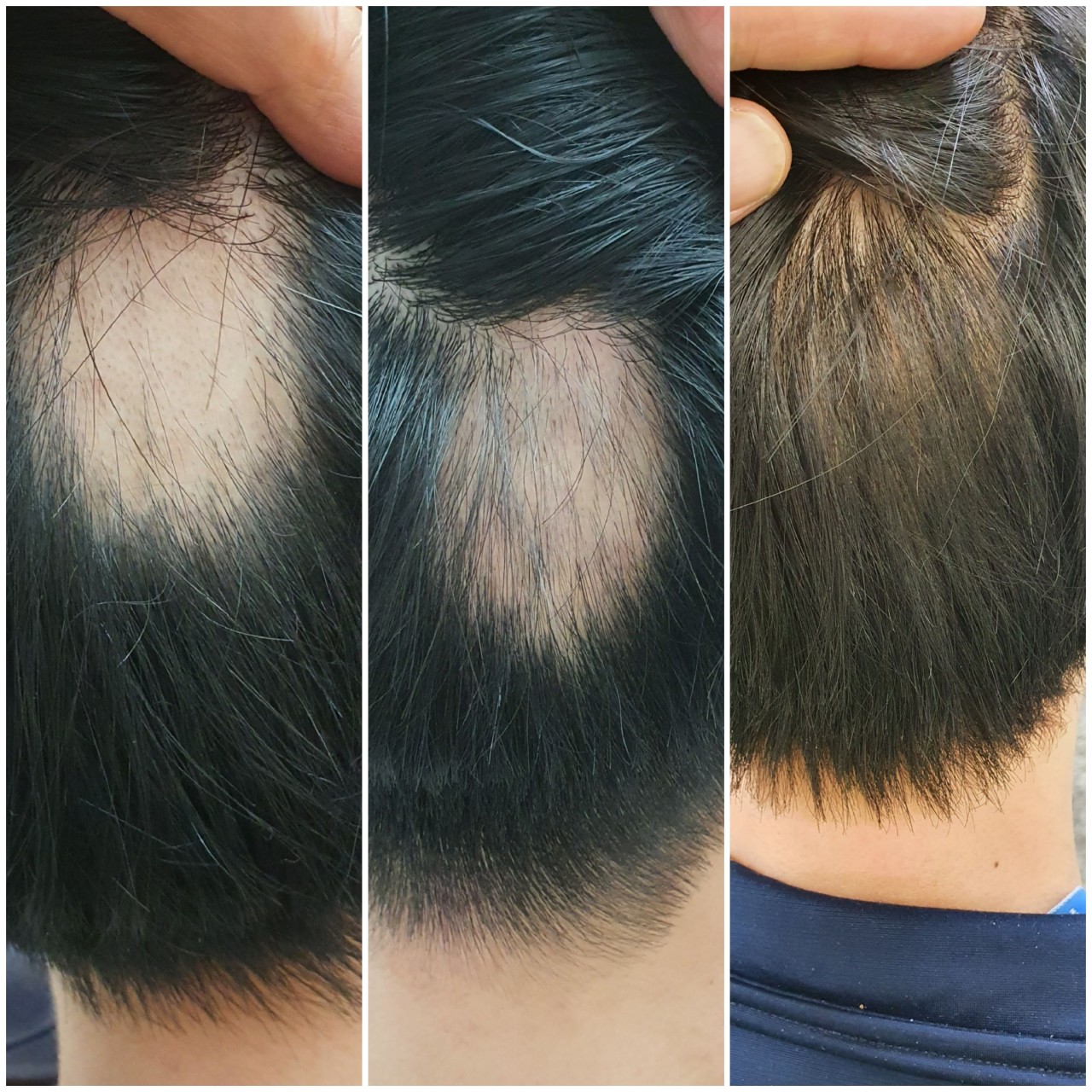 헤드스파k-평택-서정점-탈모-관리-두피-케어.jpeg