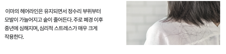 헤드스파k-여성형-탈모.png