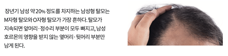 헤드스파k-남성형-탈모.png