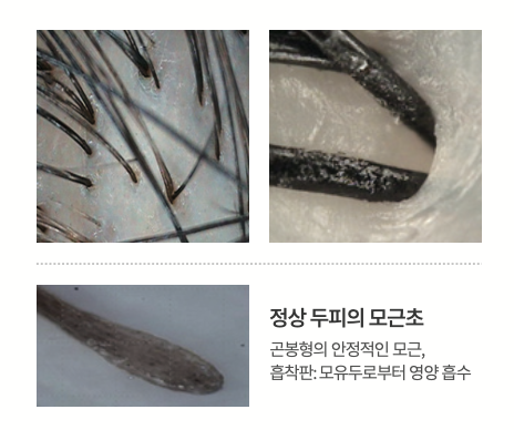 헤드스파k-정상-두피-모근.png