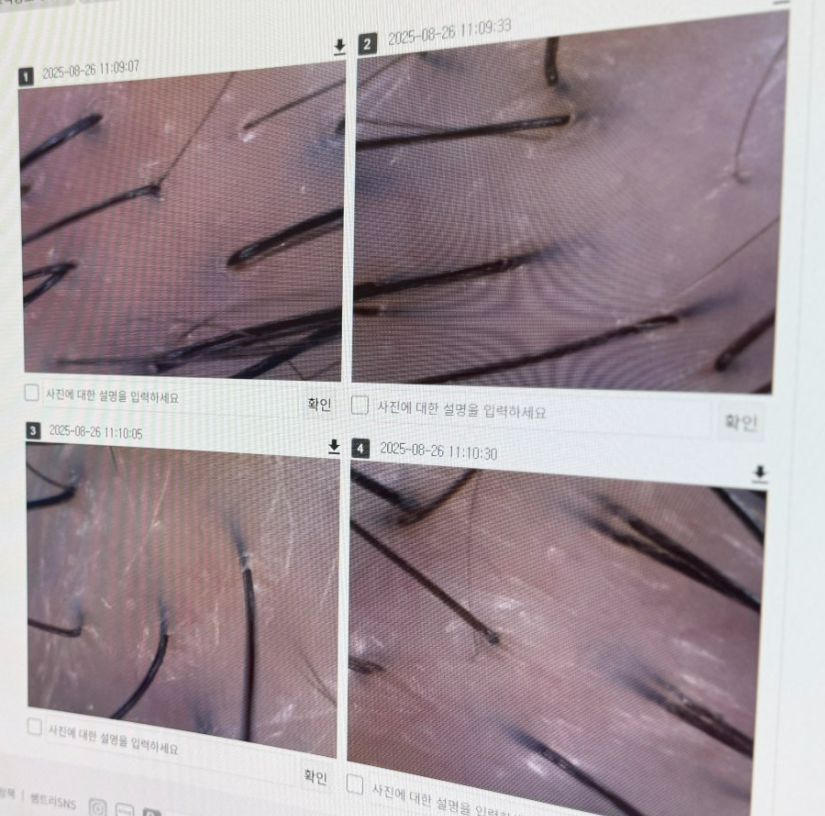 관리 전 두피 상태