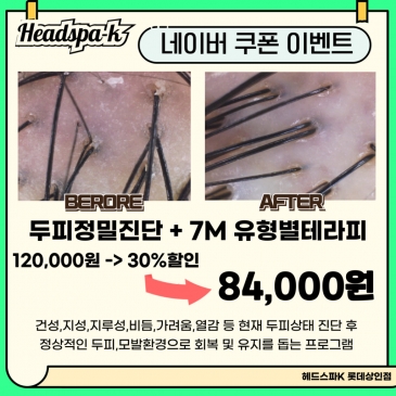 [롯데백화점 상인점] ✨ 9월 이벤트 | 두피 정밀진단 + 7M 유형별 테라피 30% 할인
